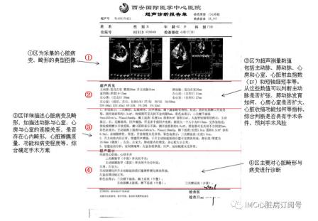 如何看懂心脏超声结果？